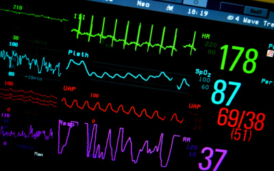 Stojíme pred potrebou radikálnej reformy zdravotníctva - sme však na ňu pripravení?