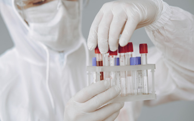 Informácie k testovaniu na ITAPA 2020